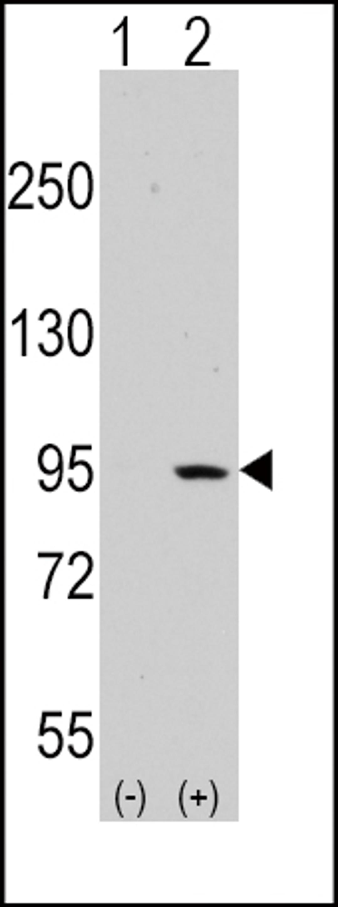 Western blot analysis of DDR1 using rabbit polyclonal DDR1 Antibody.293 cell lysates (2 ug/lane) either nontransfected (Lane 1) or transiently transfected with the DDR1 gene (Lane 2).