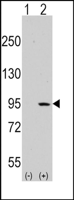 Western blot analysis of DDR1 using rabbit polyclonal DDR1 Antibody.293 cell lysates (2 ug/lane) either nontransfected (Lane 1) or transiently transfected with the DDR1 gene (Lane 2).