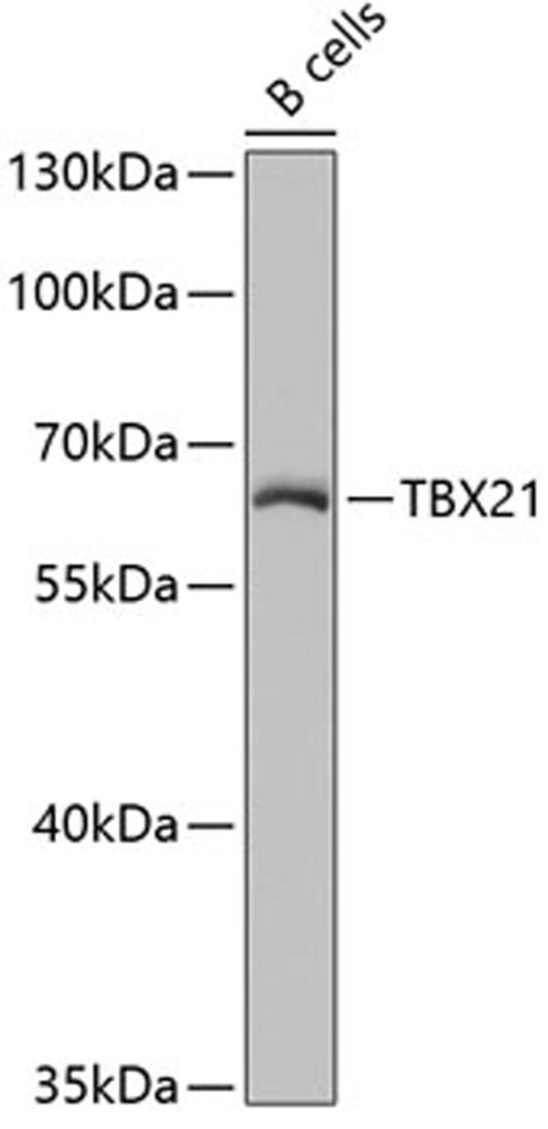 Western blot - TBX21 antibody (A4682)