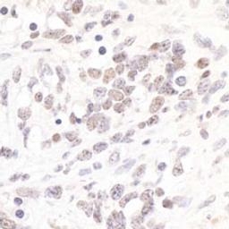 Detection of mouse TIF1 alpha/TRIM24 by immunohistochemistry.