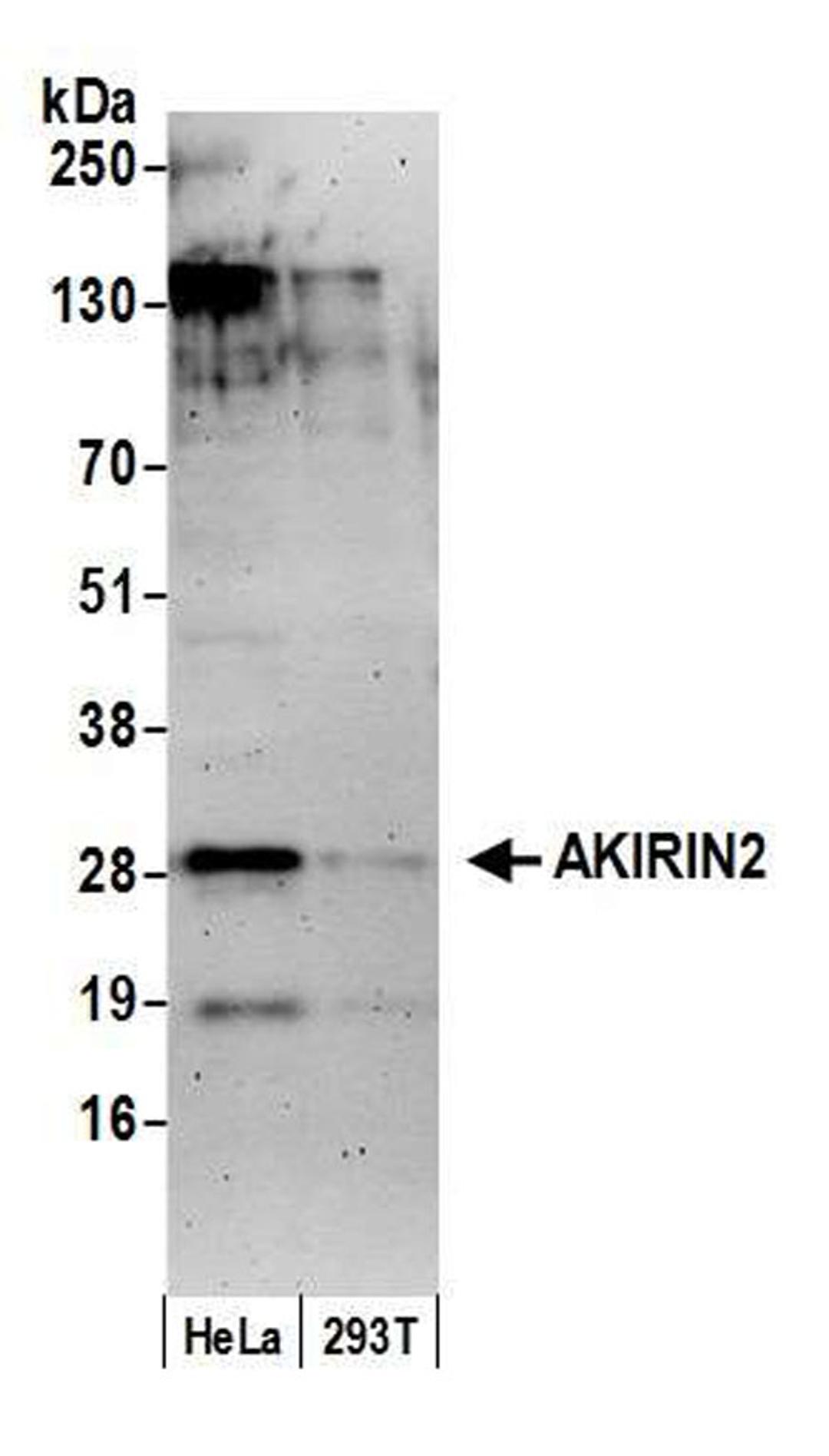 Detection of human AKIRIN2 by WB.