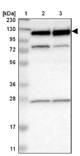 Western Blot: RBM5 Antibody [NBP1-83304] - Lane 1: Marker [kDa] 230, 130, 95, 72, 56, 36, 28, 17, 11<br/>Lane 2: Human cell line RT-4<br/>Lane 3: Human cell line U-251MG sp