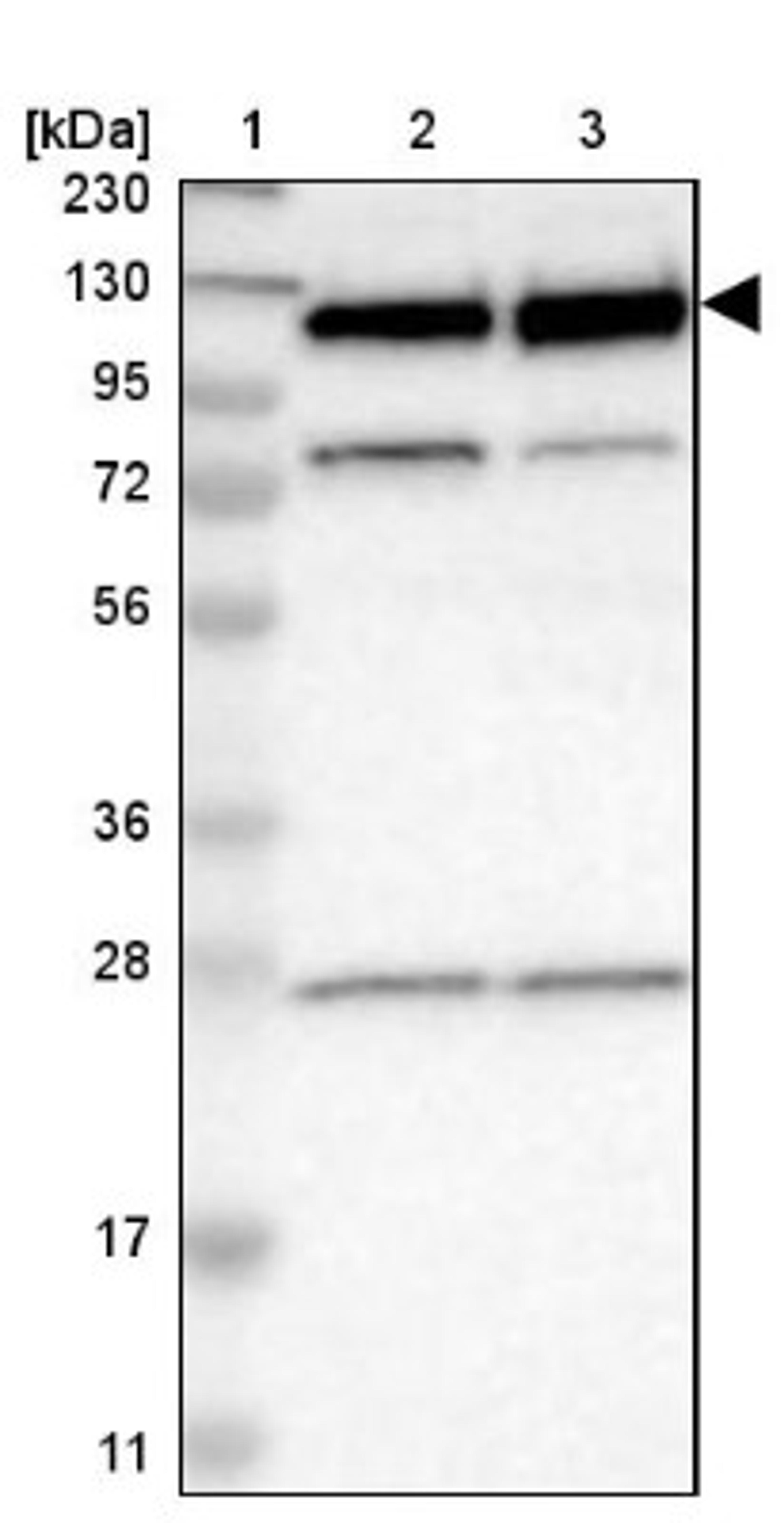 Western Blot: RBM5 Antibody [NBP1-83304] - Lane 1: Marker [kDa] 230, 130, 95, 72, 56, 36, 28, 17, 11<br/>Lane 2: Human cell line RT-4<br/>Lane 3: Human cell line U-251MG sp