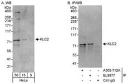 Detection of human KLC2 by western blot and immunoprecipitation.