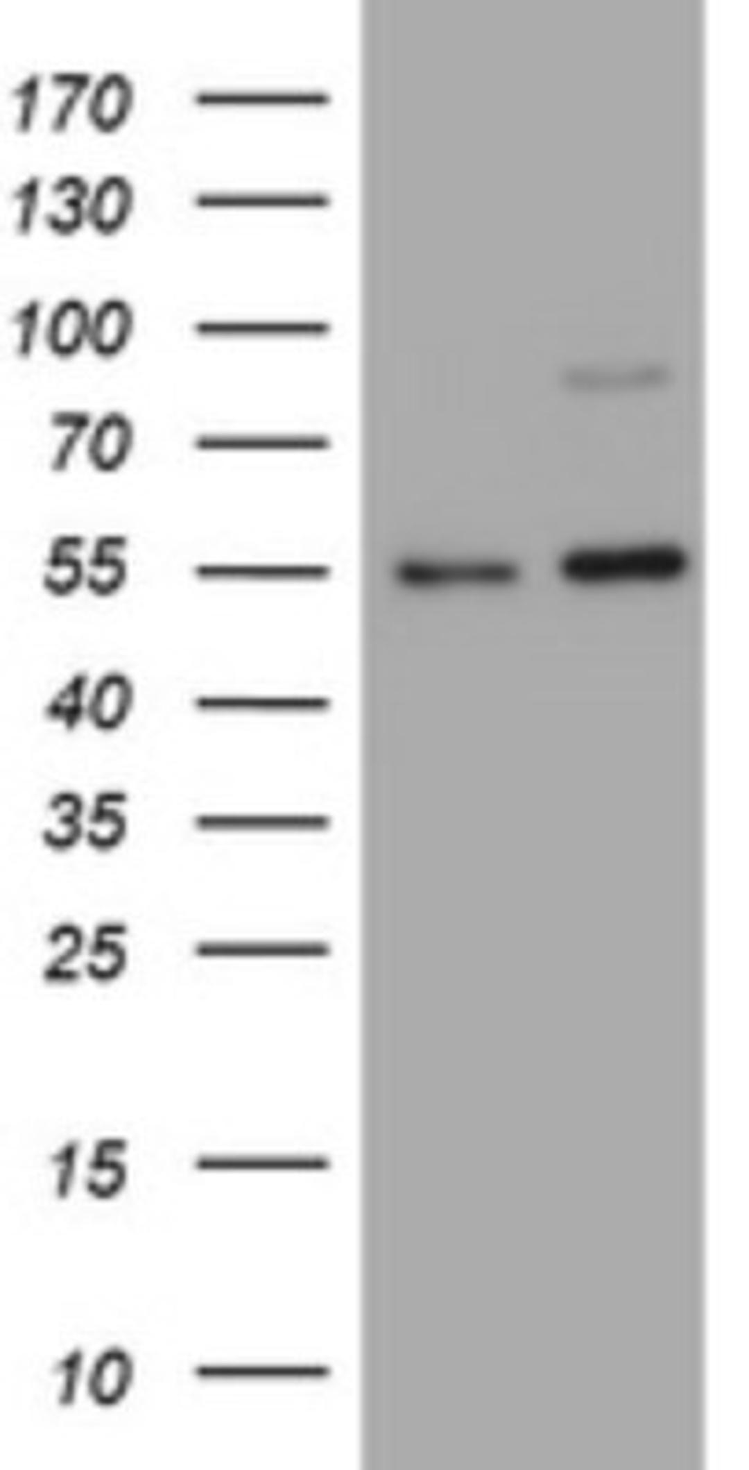 Western Blot: CD30/TNFRSF8 Antibody (1C6) [NBP2-46157] - Analysis of HEK293T cells were transfected with the pCMV6-ENTRY control (Left lane) or pCMV6-ENTRY TNFRSF8.