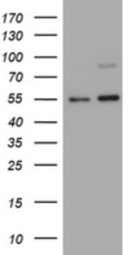 Western Blot: CD30/TNFRSF8 Antibody (1C6) [NBP2-46157] - Analysis of HEK293T cells were transfected with the pCMV6-ENTRY control (Left lane) or pCMV6-ENTRY TNFRSF8.