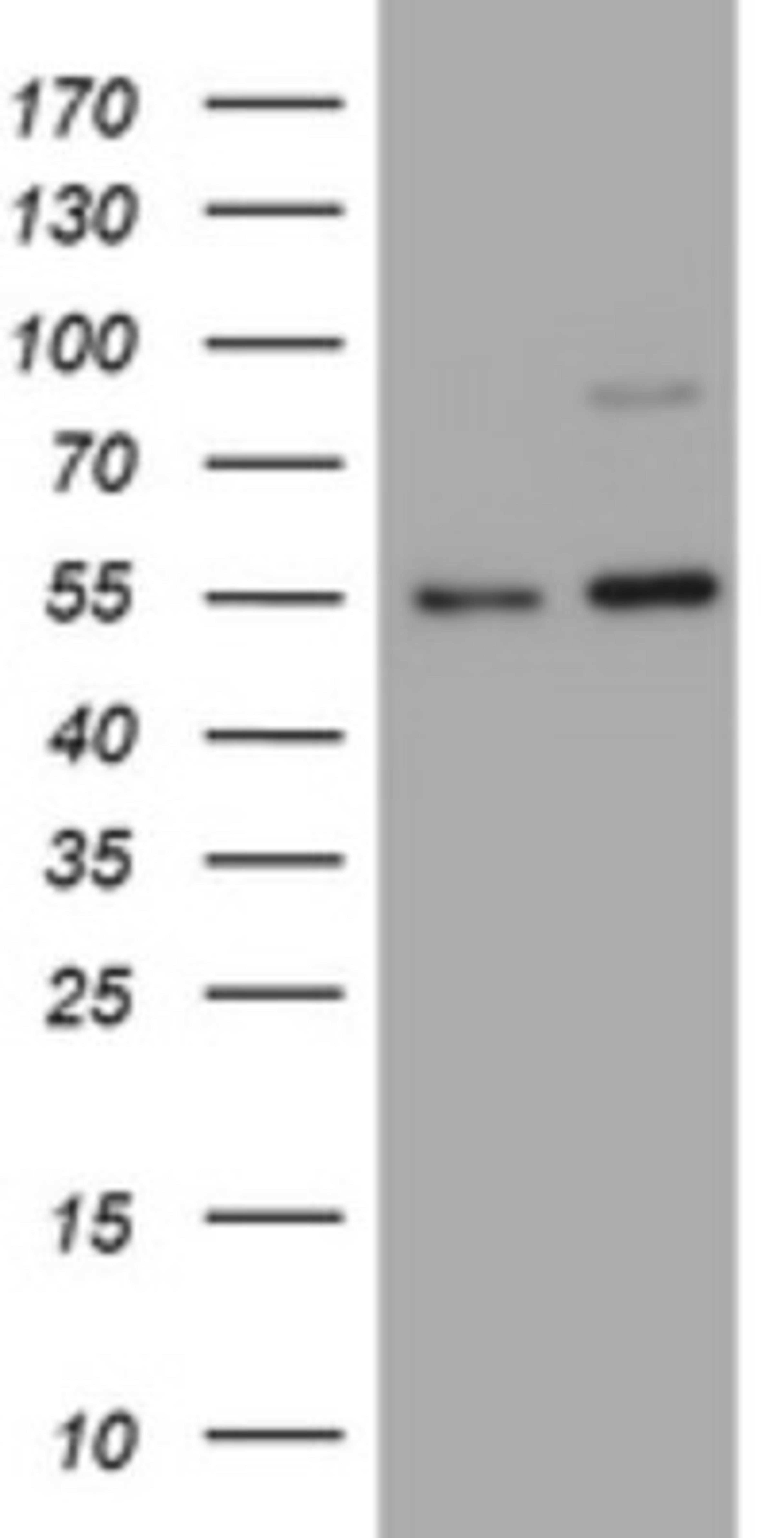 Western Blot: CD30/TNFRSF8 Antibody (1C6) [NBP2-46157] - Analysis of HEK293T cells were transfected with the pCMV6-ENTRY control (Left lane) or pCMV6-ENTRY TNFRSF8.