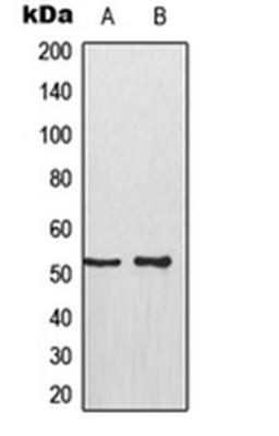 Western blot analysis of HeLa (Lane 1), A431 (Lane 2) whole cell lysates using TP53 antibody