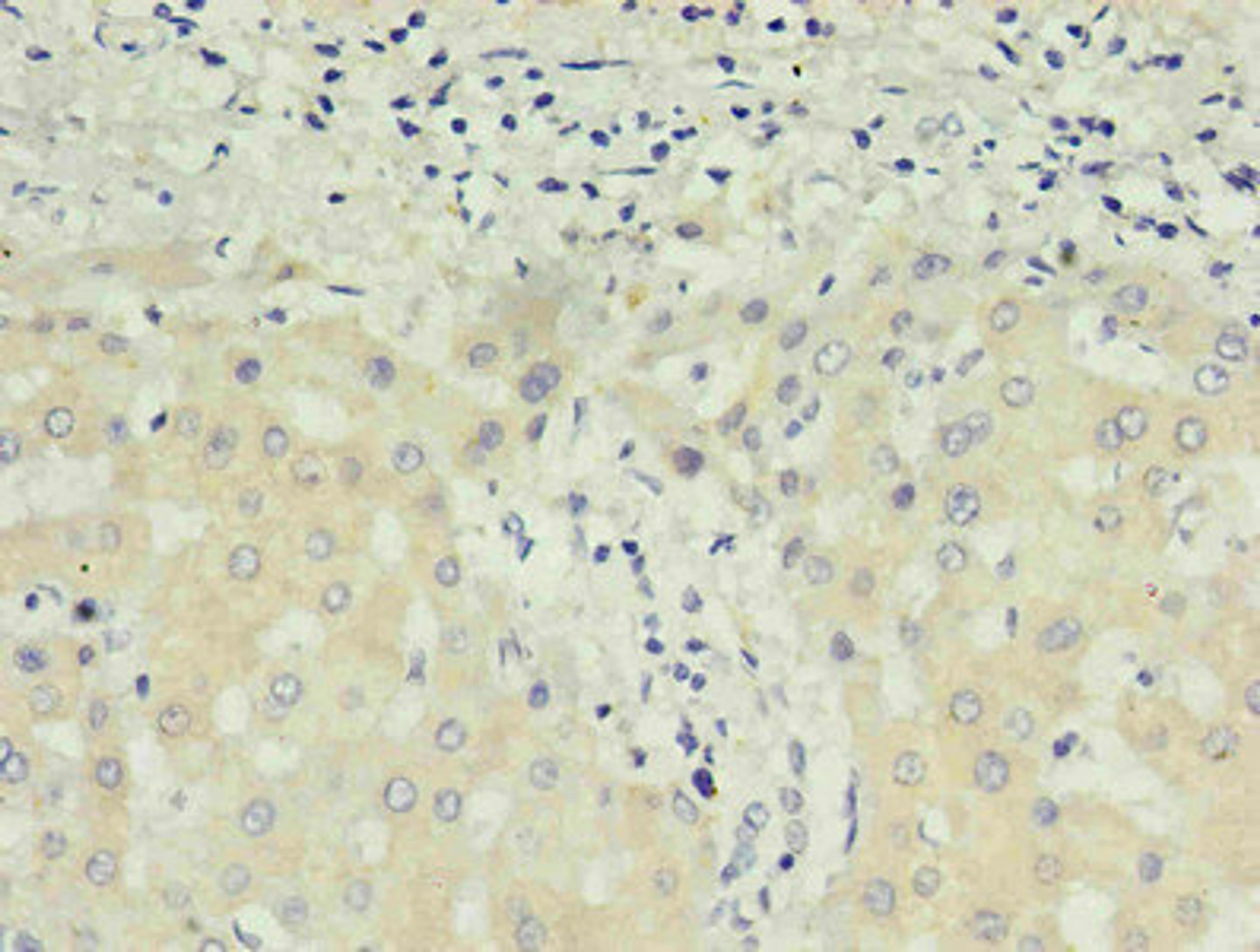 Immunohistochemistry of paraffin-embedded human liver using CSB-MA027711E0m in 30ug/ml dilute concentrations.