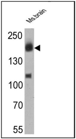 Western Blot: ErbB4/Her4 Antibody (H4.77.16) [NB120-3104] - Analysis of 25 ug of mouse brain cell lysates.