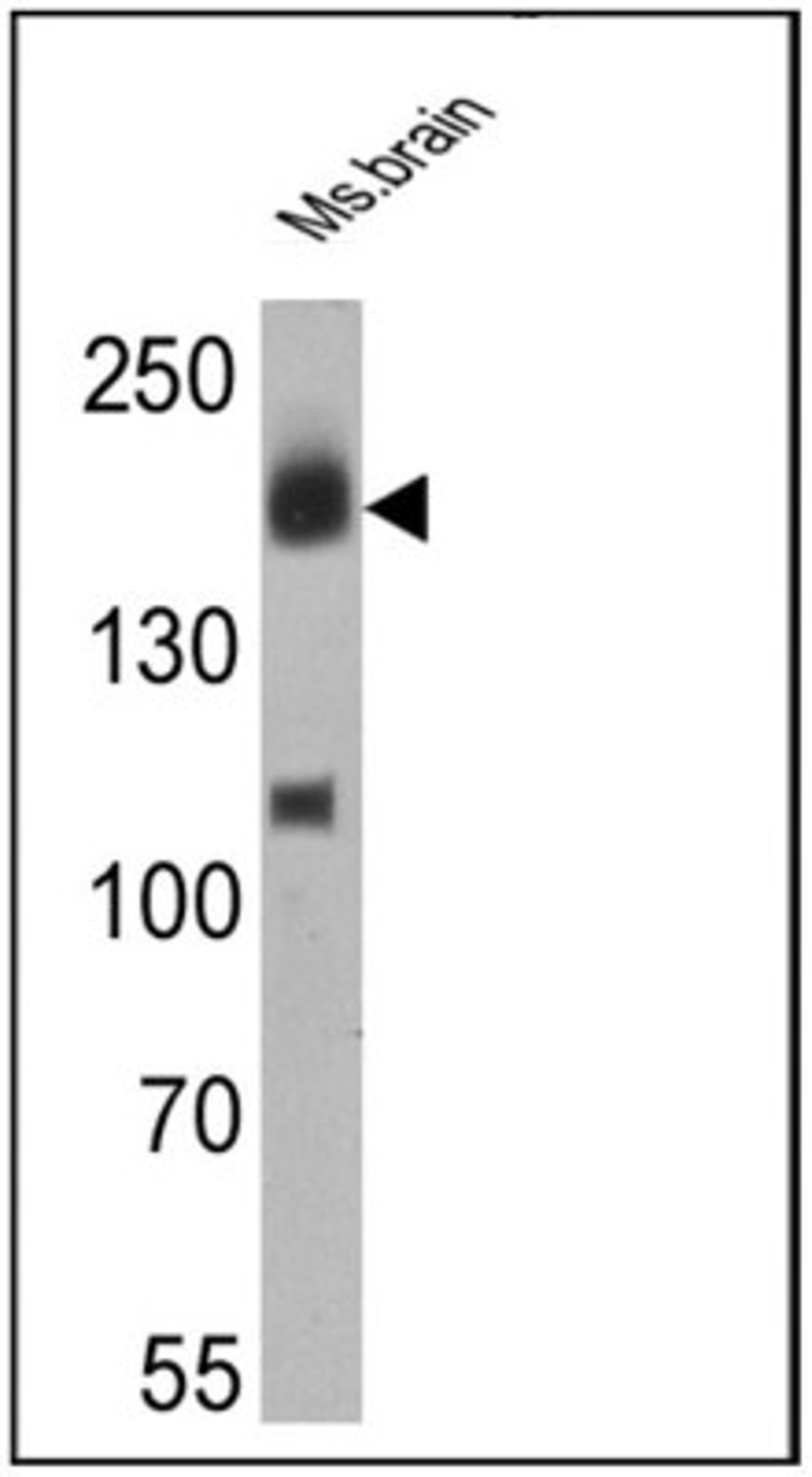 Western Blot: ErbB4/Her4 Antibody (H4.77.16) [NB120-3104] - Analysis of 25 ug of mouse brain cell lysates.