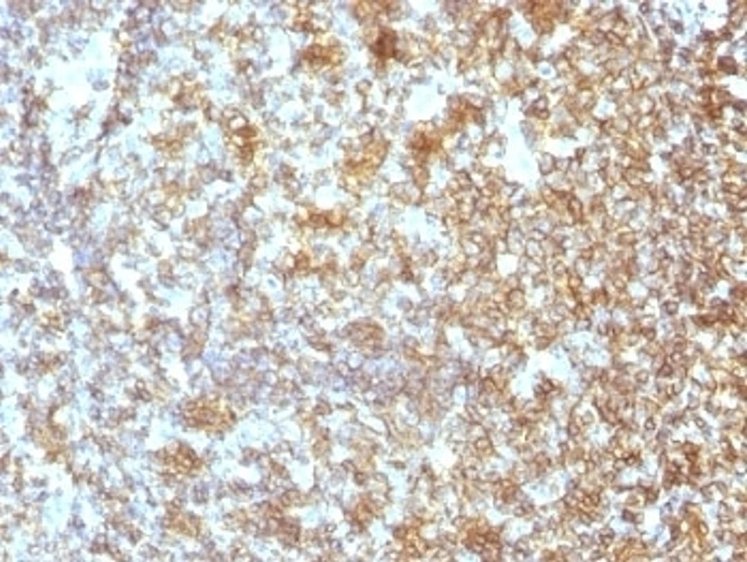 IHC test of FFPE human tonsil probed with CD45RA antibody