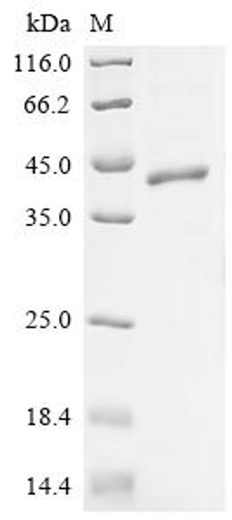 (Tris-Glycine gel) Discontinuous SDS-PAGE (reduced) with 5% enrichment gel and 15% separation gel.