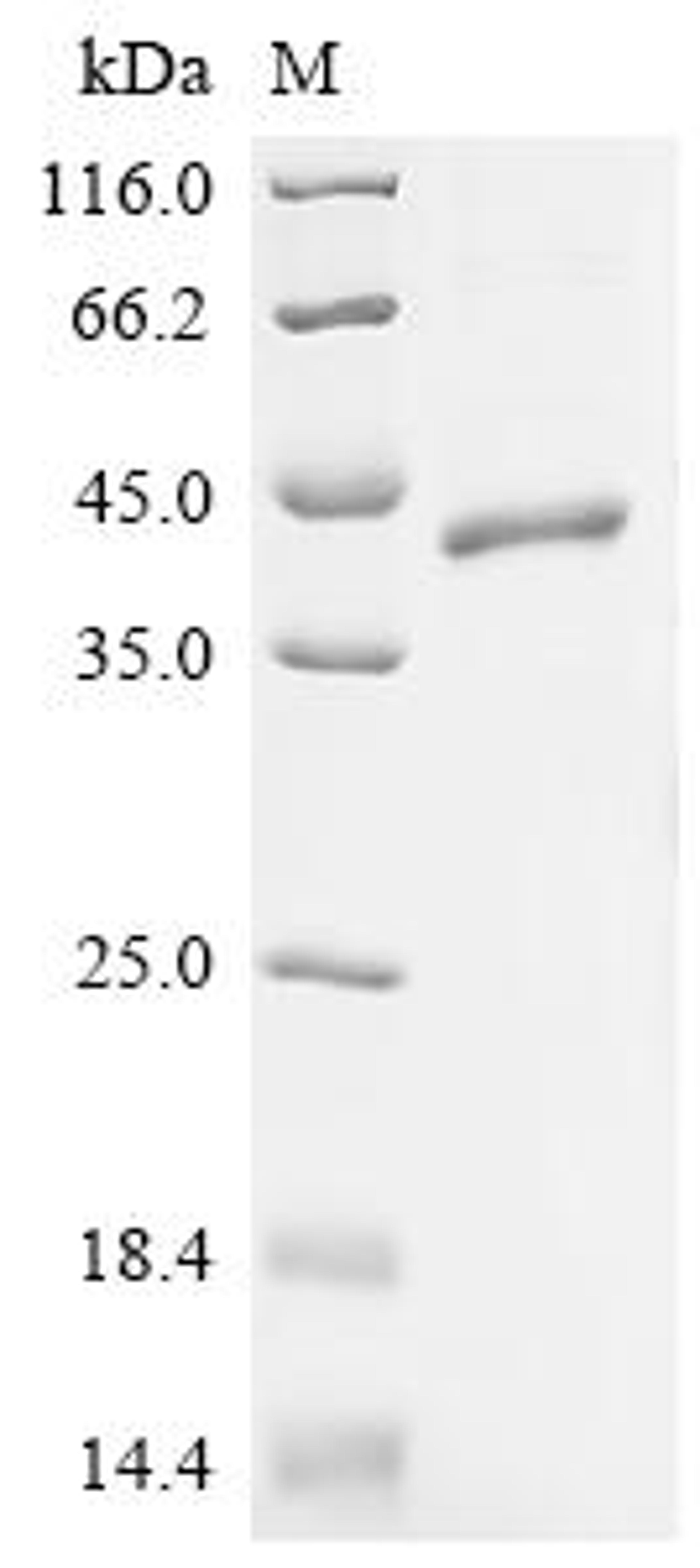 (Tris-Glycine gel) Discontinuous SDS-PAGE (reduced) with 5% enrichment gel and 15% separation gel.