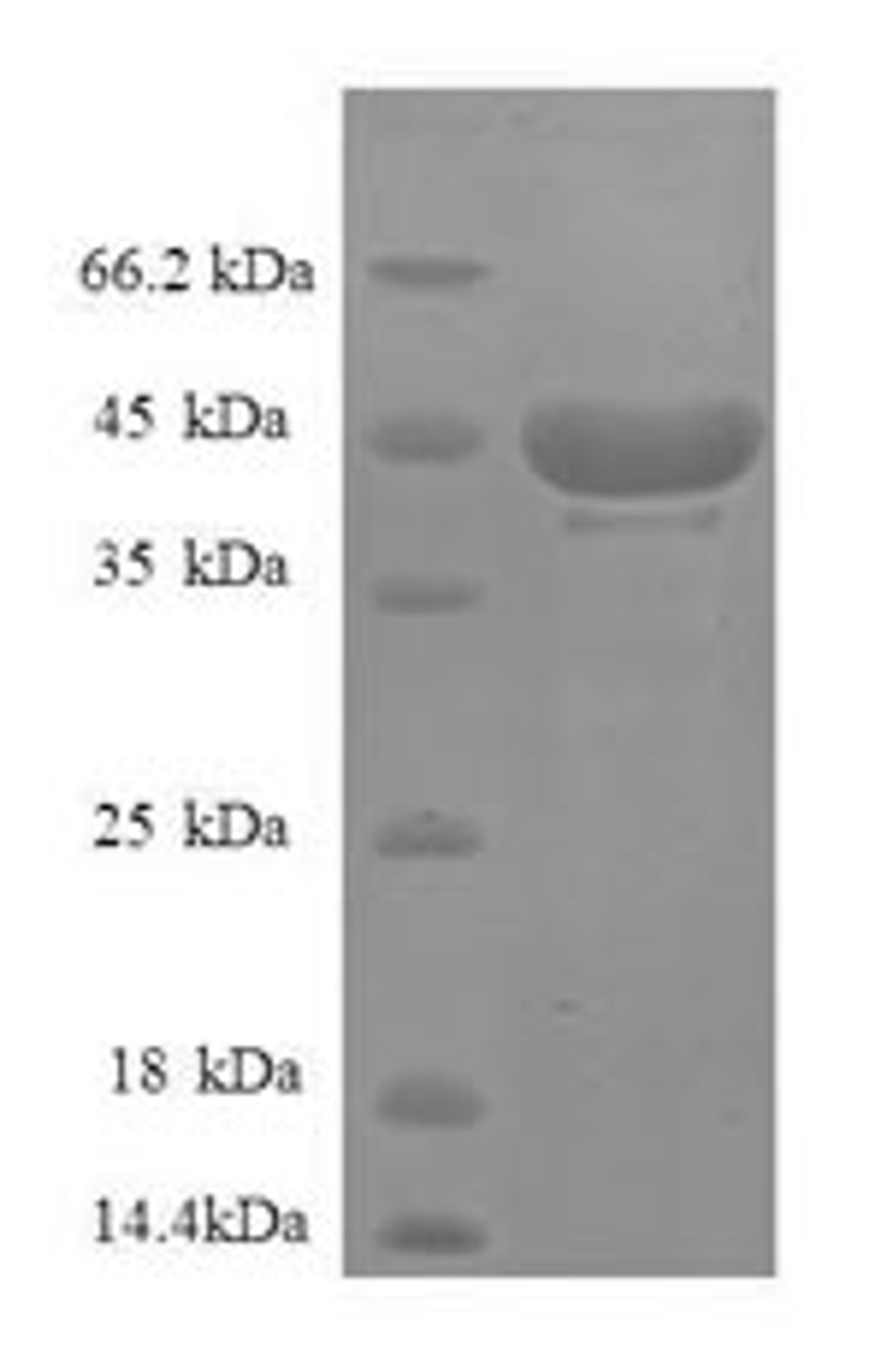 (Tris-Glycine gel) Discontinuous SDS-PAGE (reduced) with 5% enrichment gel and 15% separation gel.
