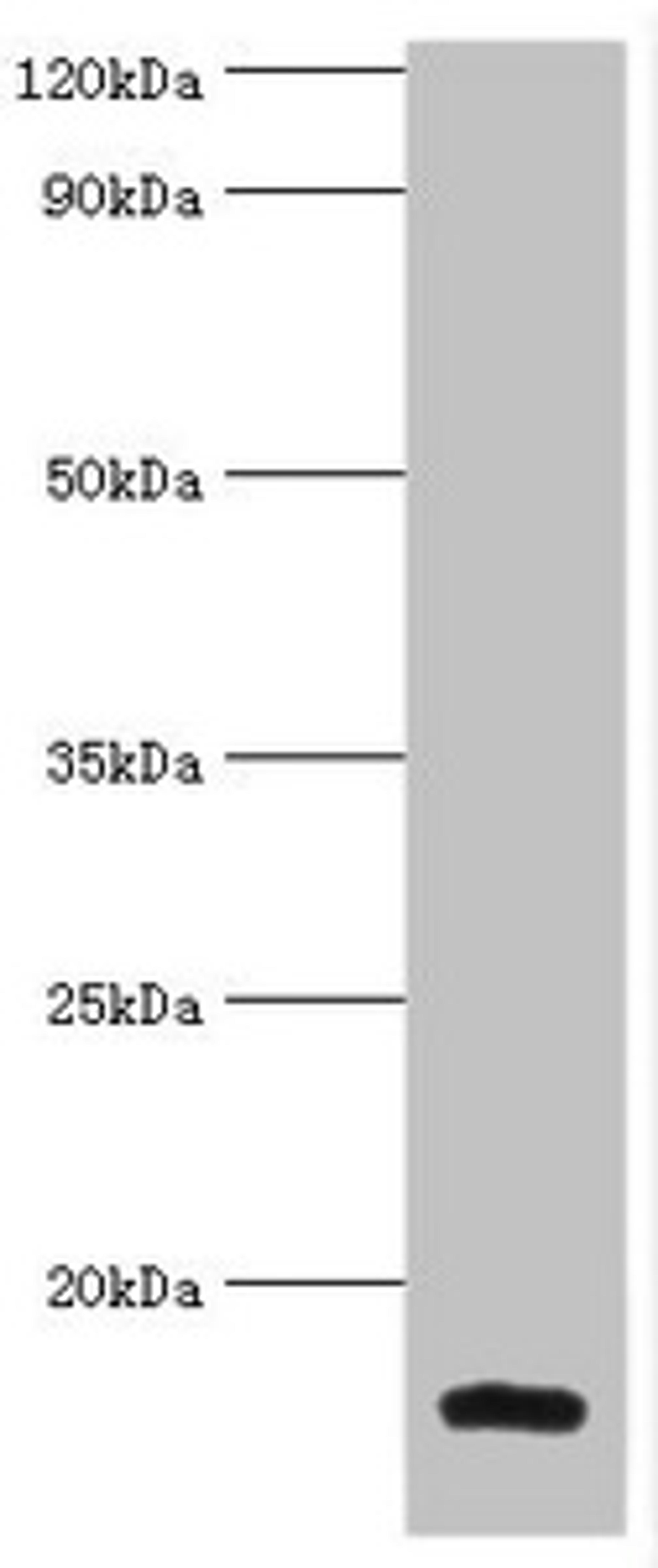 Western blot. All lanes: Galectin-2 antibody at 6ug/ml + Mouse liver tissue. Secondary. Goat polyclonal to rabbit IgG at 1/10000 dilution. Predicted band size: 15 kDa. Observed band size: 15 kDa.