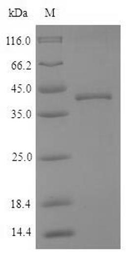 (Tris-Glycine gel) Discontinuous SDS-PAGE (reduced) with 5% enrichment gel and 15% separation gel.