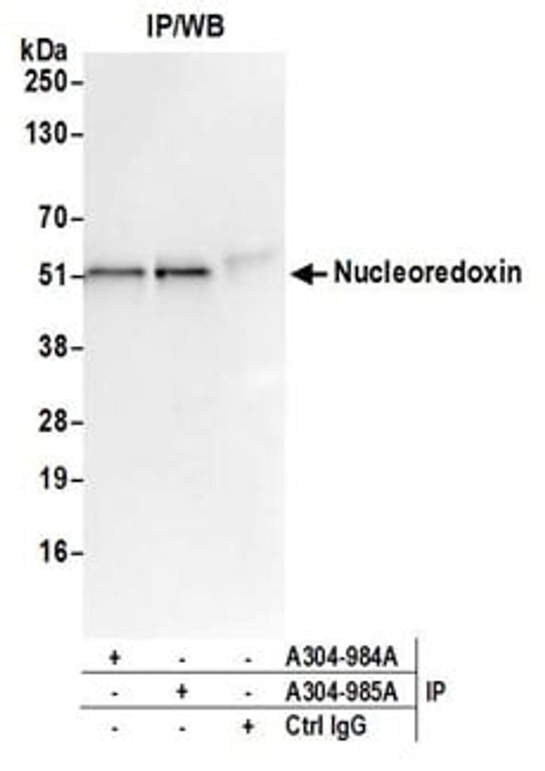 Detection of human Nucleoredoxin by western blot of immunoprecipitates.