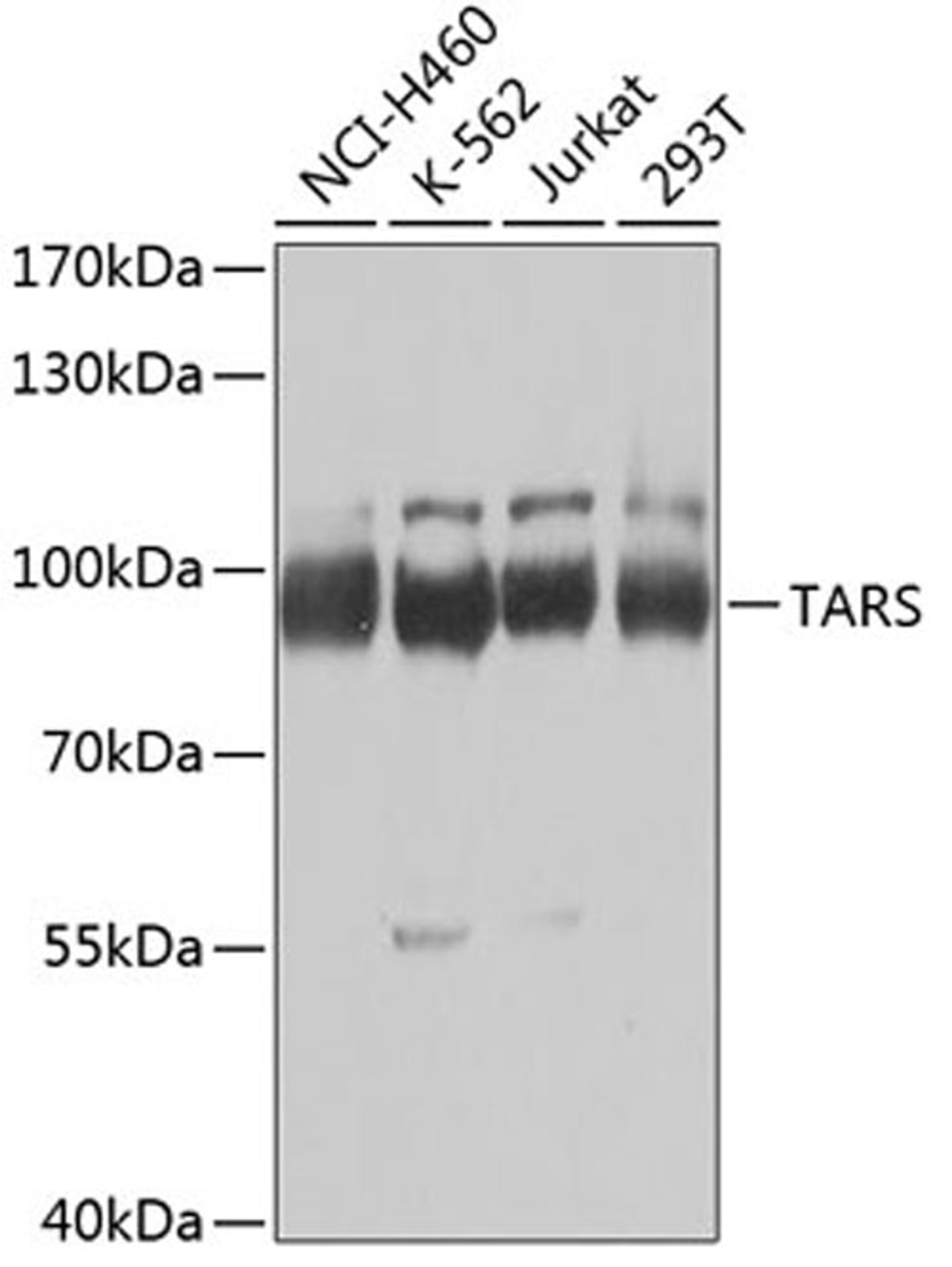 Western blot - TARS Antibody (A6993)