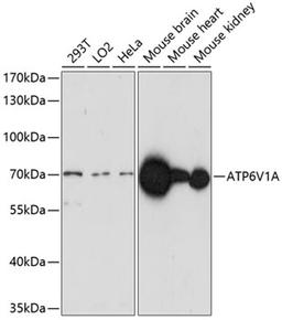 Western blot - ATP6V1A antibody (A14706)