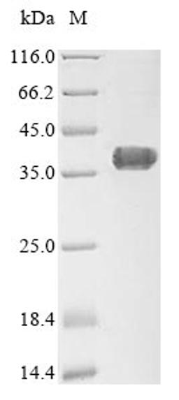 (Tris-Glycine gel) Discontinuous SDS-PAGE (reduced) with 5% enrichment gel and 15% separation gel.