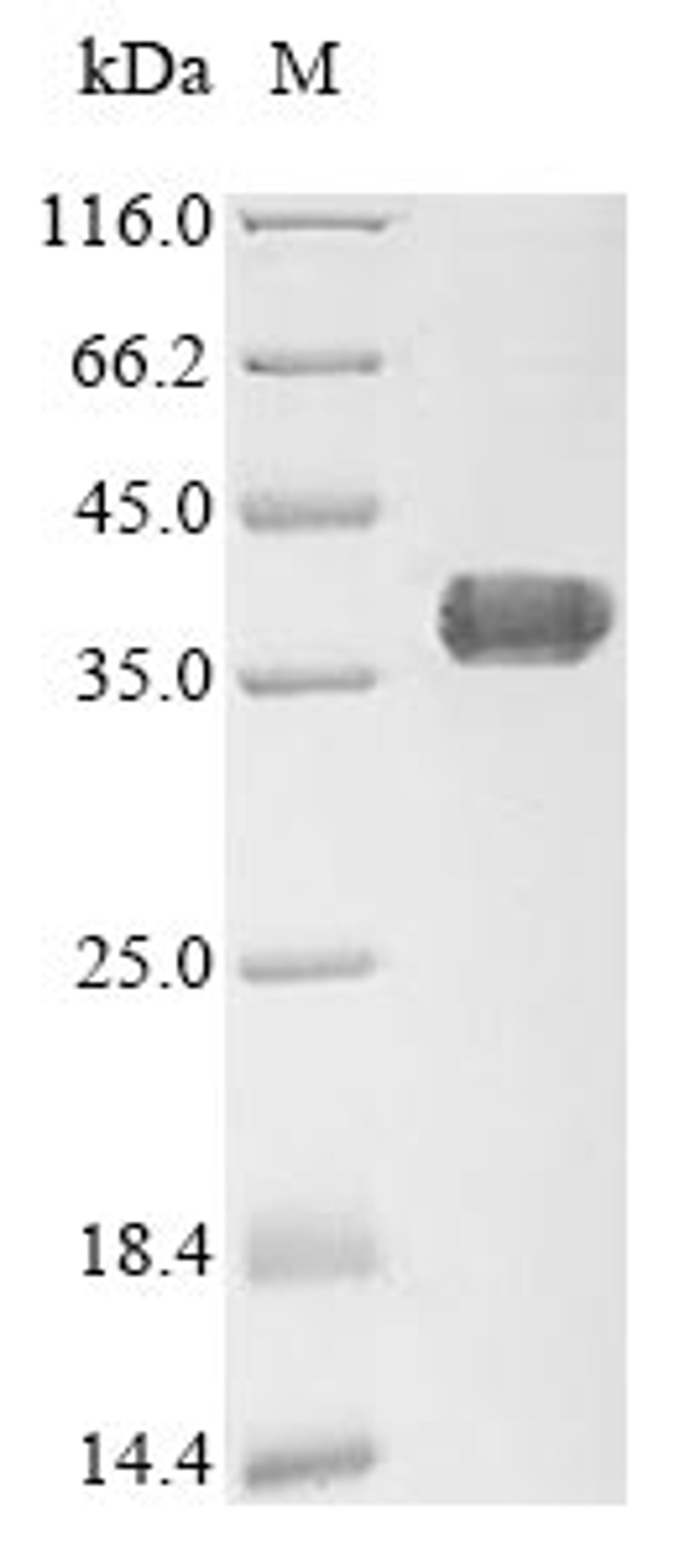 (Tris-Glycine gel) Discontinuous SDS-PAGE (reduced) with 5% enrichment gel and 15% separation gel.