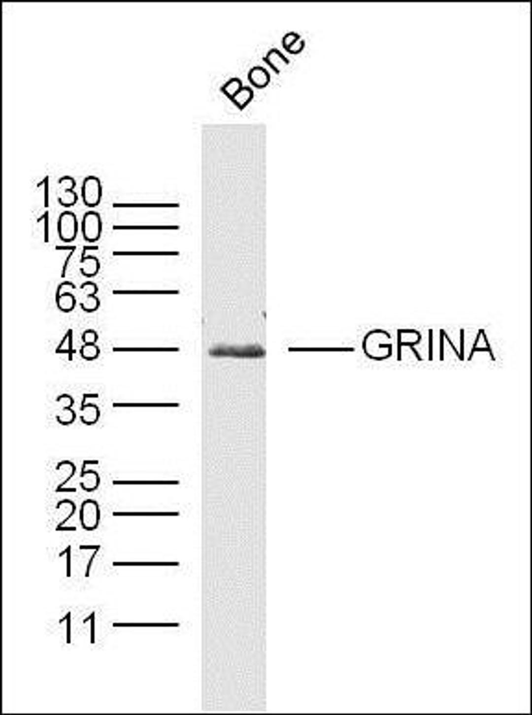 Western blot analysis of mouse Bone lysates (Lane 1) using GRINA antibody.