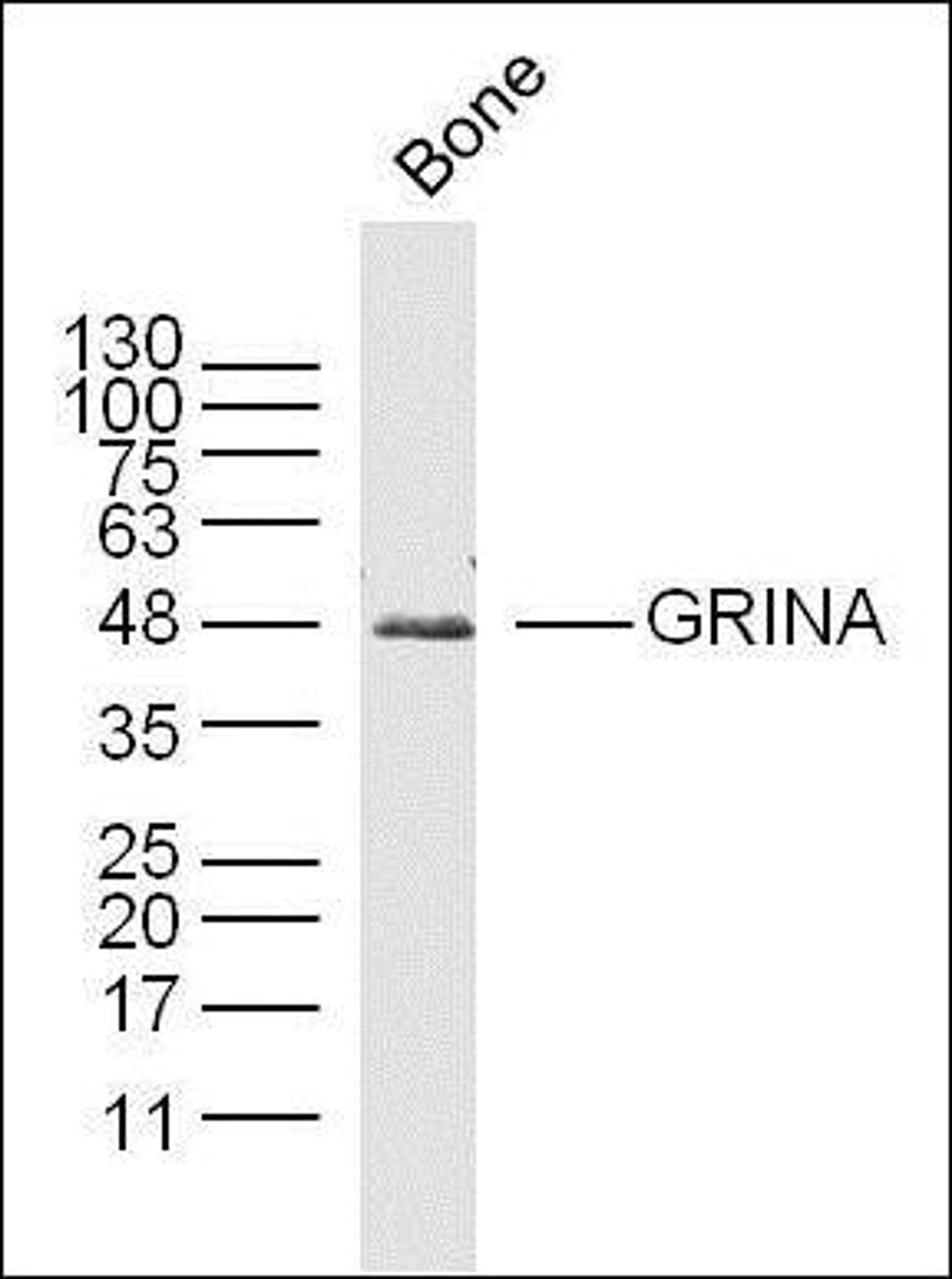 Western blot analysis of mouse Bone lysates (Lane 1) using GRINA antibody.