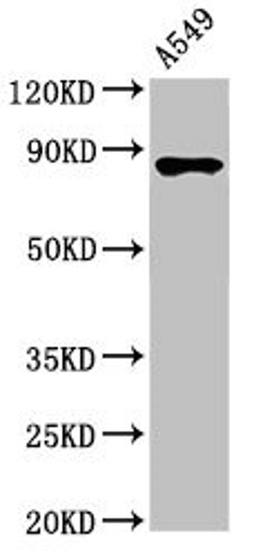 Western Blot. Positive WB detected in: A549 whole cell lysate. All lanes: IKBKB antibody at 3.4µg/ml. Secondary. Goat polyclonal to rabbit IgG at 1/50000 dilution. Predicted band size: 87, 86, 30, 80 kDa. Observed band size: 87 kDa