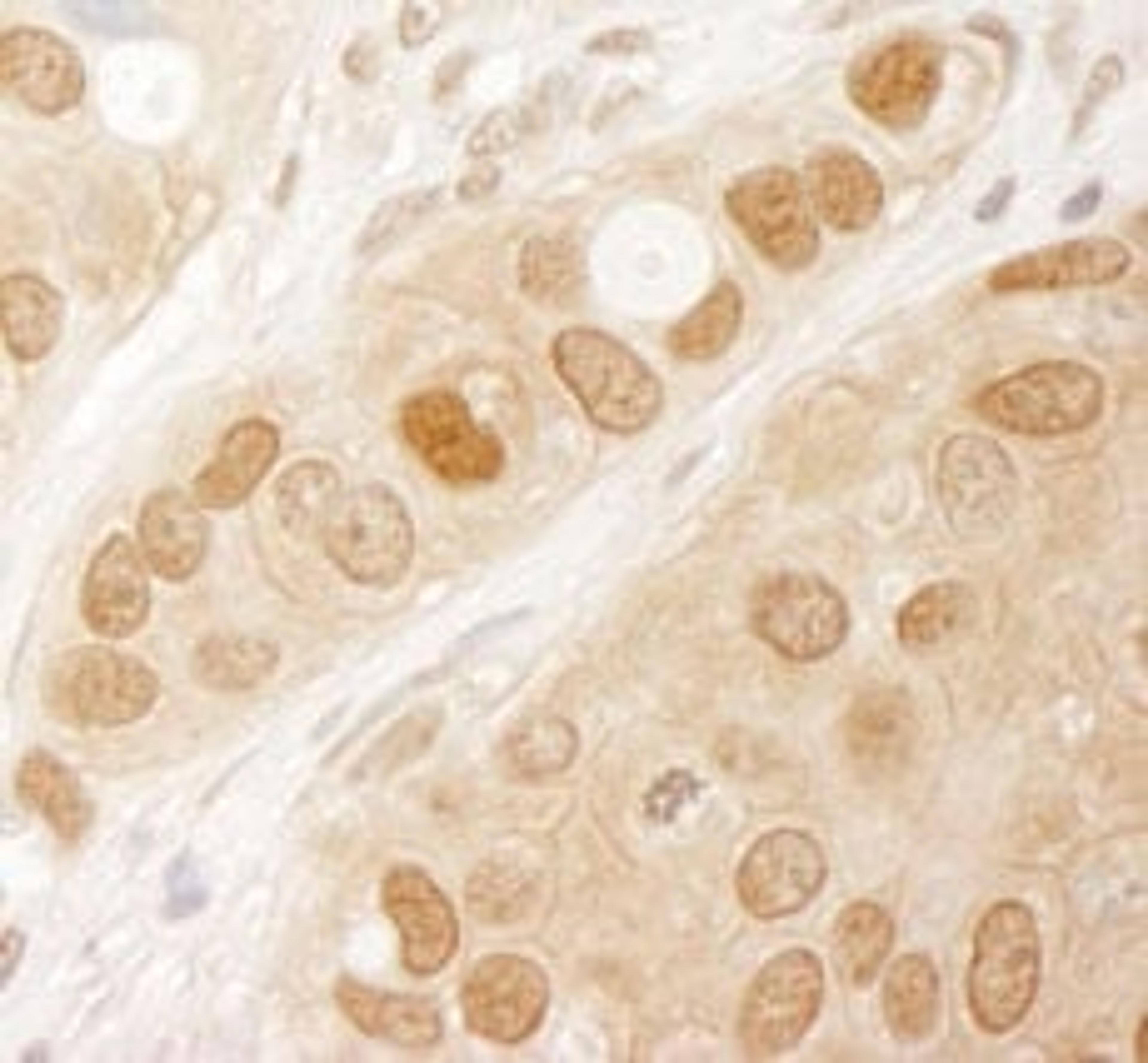 Detection of human AKT1 by immunohistochemistry.