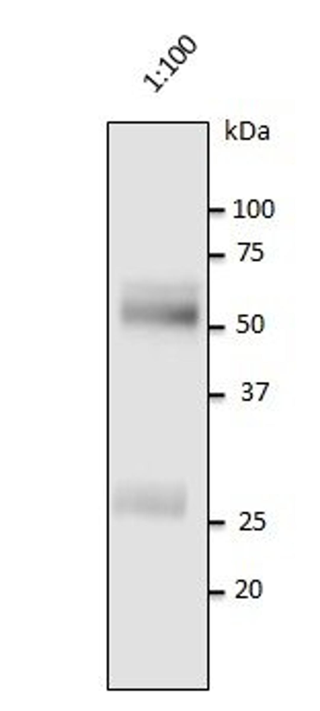 Western blot analysis of staining of human serum using Human IgG antibody