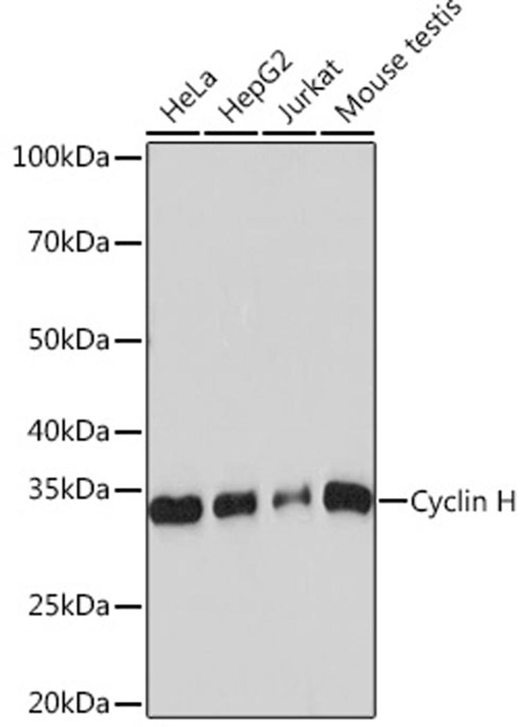 Western blot - Cyclin H Rabbit mAb (A4076)