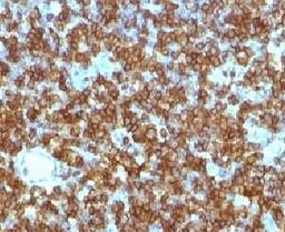 IHC test of FFPE human tonsil probed with CD45RA antibody