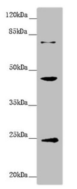 Western blot. All lanes: GNA15 antibody at 1.41 ug/ml + Mouse liver tissue. Secondary. Goat polyclonal to rabbit IgG at 1/10000 dilution. Predicted band size: 44 kDa. Observed band size: 44, 24, 72 kDa.