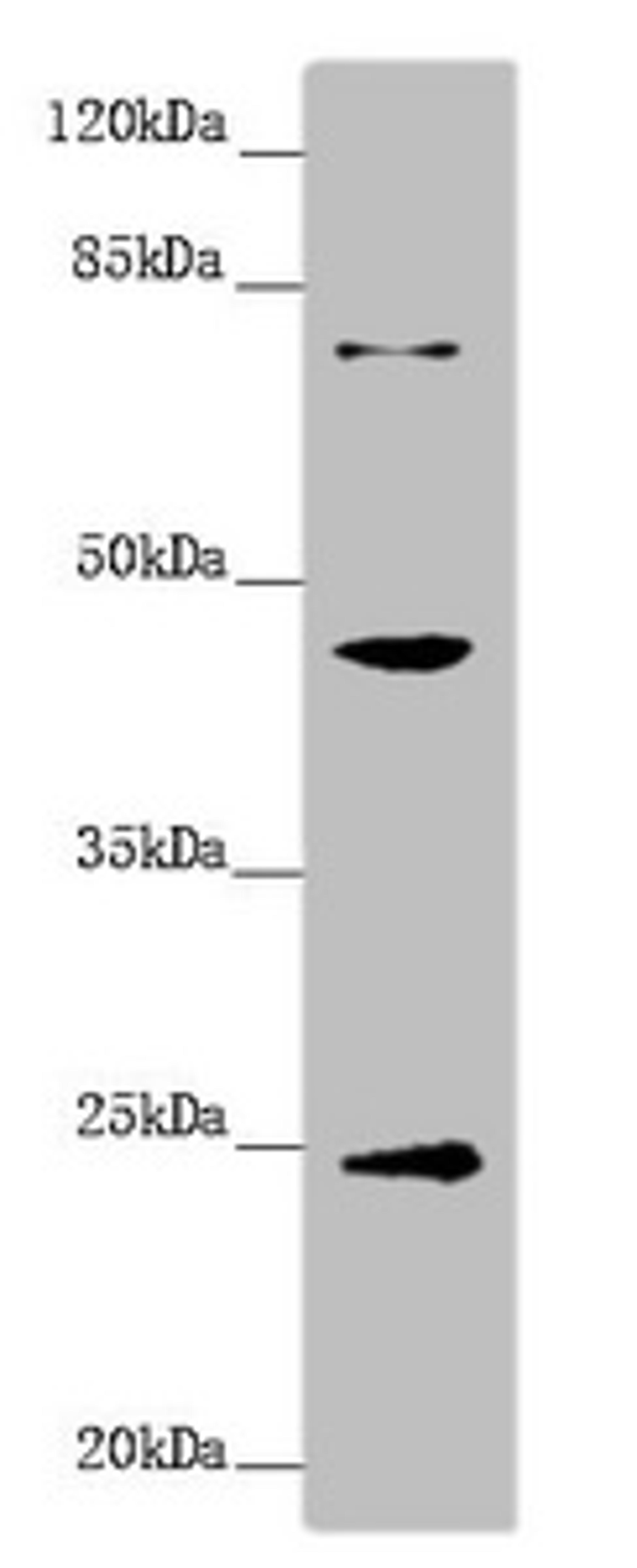 Western blot. All lanes: GNA15 antibody at 1.41 ug/ml + Mouse liver tissue. Secondary. Goat polyclonal to rabbit IgG at 1/10000 dilution. Predicted band size: 44 kDa. Observed band size: 44, 24, 72 kDa.