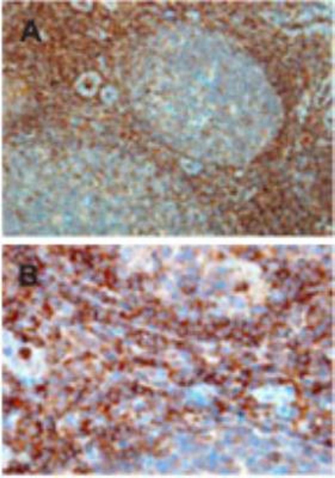 Immunohistochemistry-Paraffin: RAC2 Antibody [NBP2-31086] - Staining of human tonsil using this antibody. A) Strong staining in the interfollicular area and mantle zone but the majority of cells in germinal centre are negative. B) Higher magnification of interfollicular area showing positive cells.