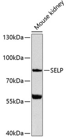 Western blot - SELP Antibody (A12501)