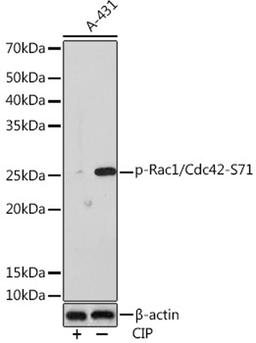 Western blot - Phospho-Rac1/Cdc42-S71 Rabbit mAb (AP1018)