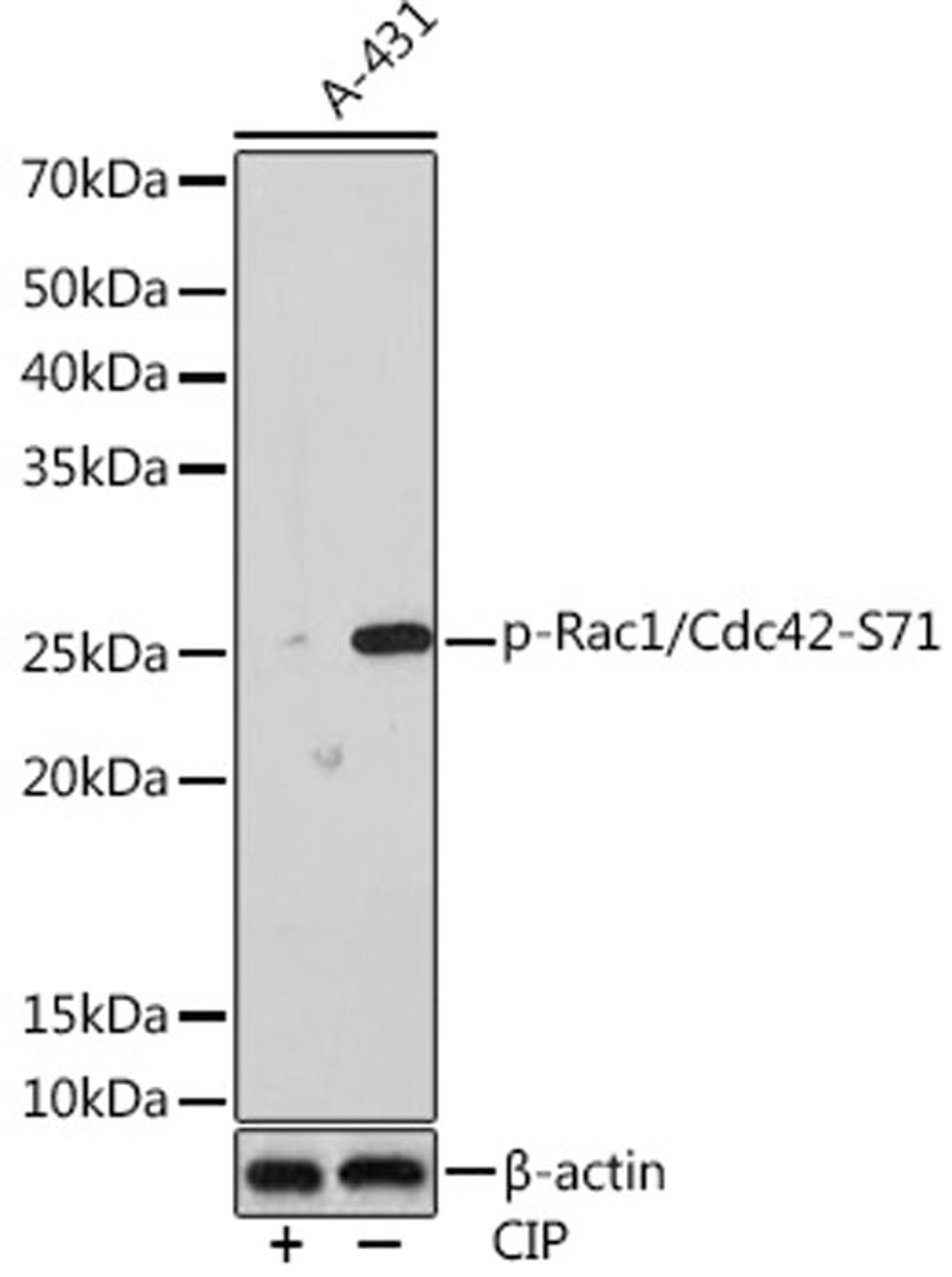 Western blot - Phospho-Rac1/Cdc42-S71 Rabbit mAb (AP1018)