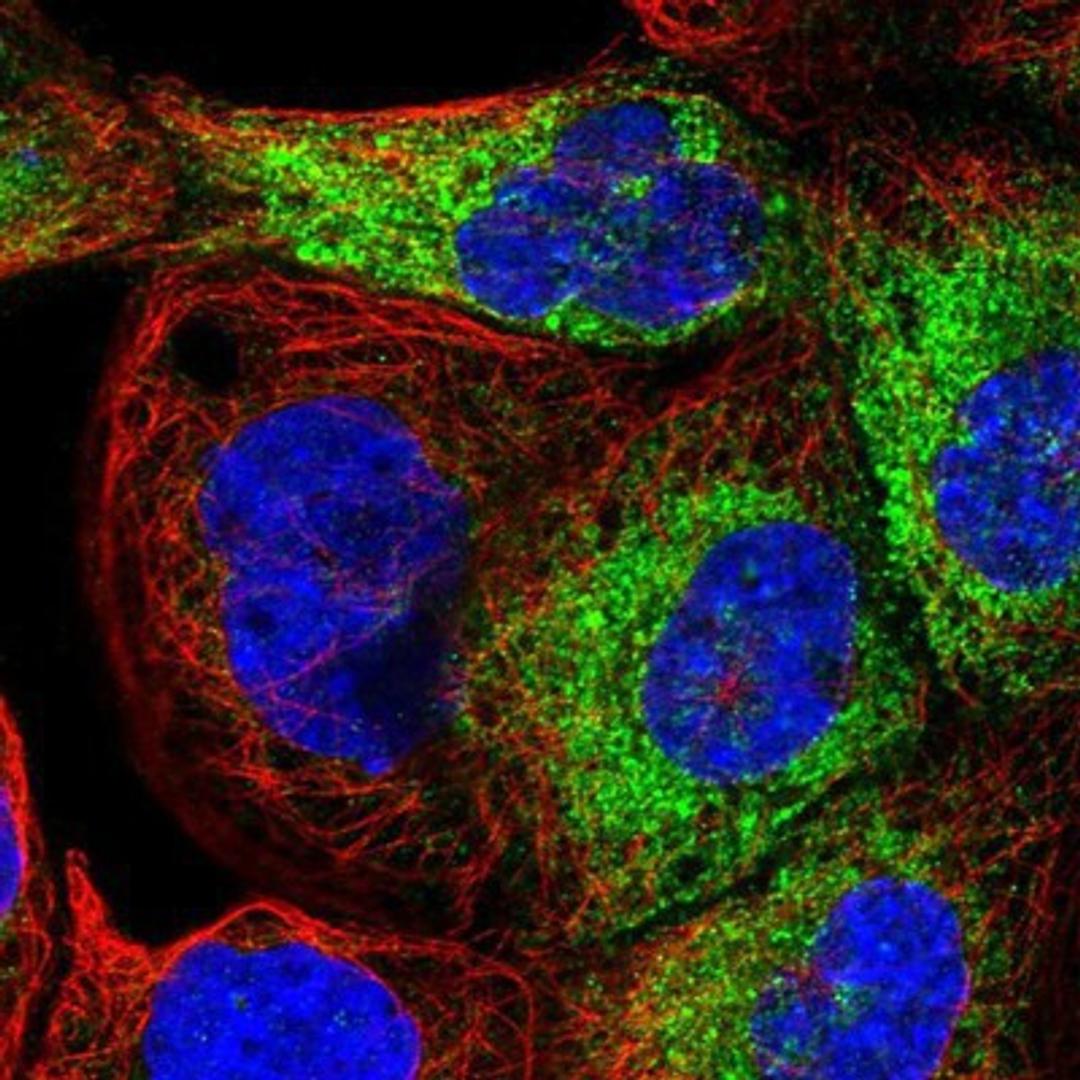 Immunocytochemistry/Immunofluorescence: STK11IP Antibody [NBP1-82885] Staining of human cell line A-431 shows positivity in cytoplasm.