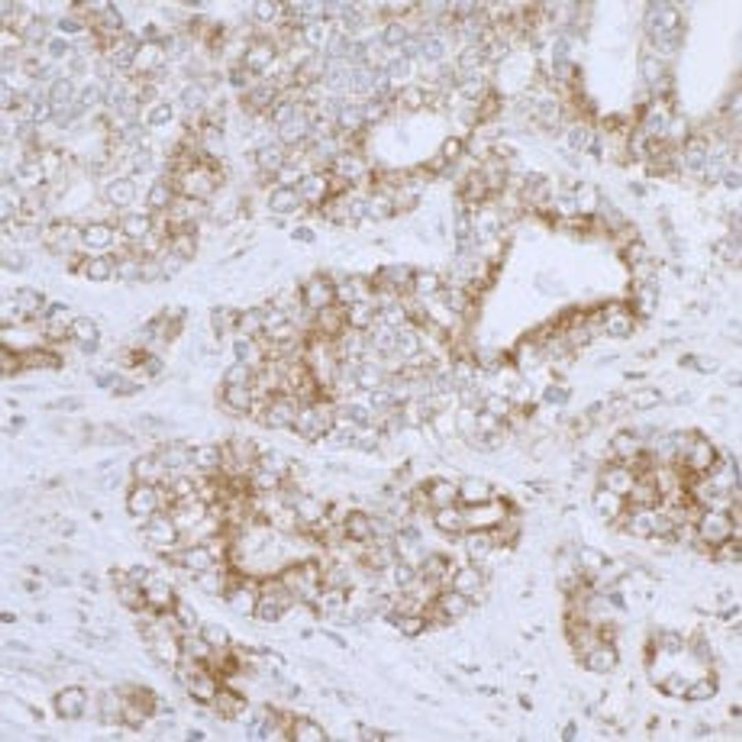 Detection of human DLD by immunohistochemistry.