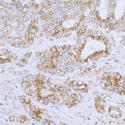 Detection of human DLD by immunohistochemistry.