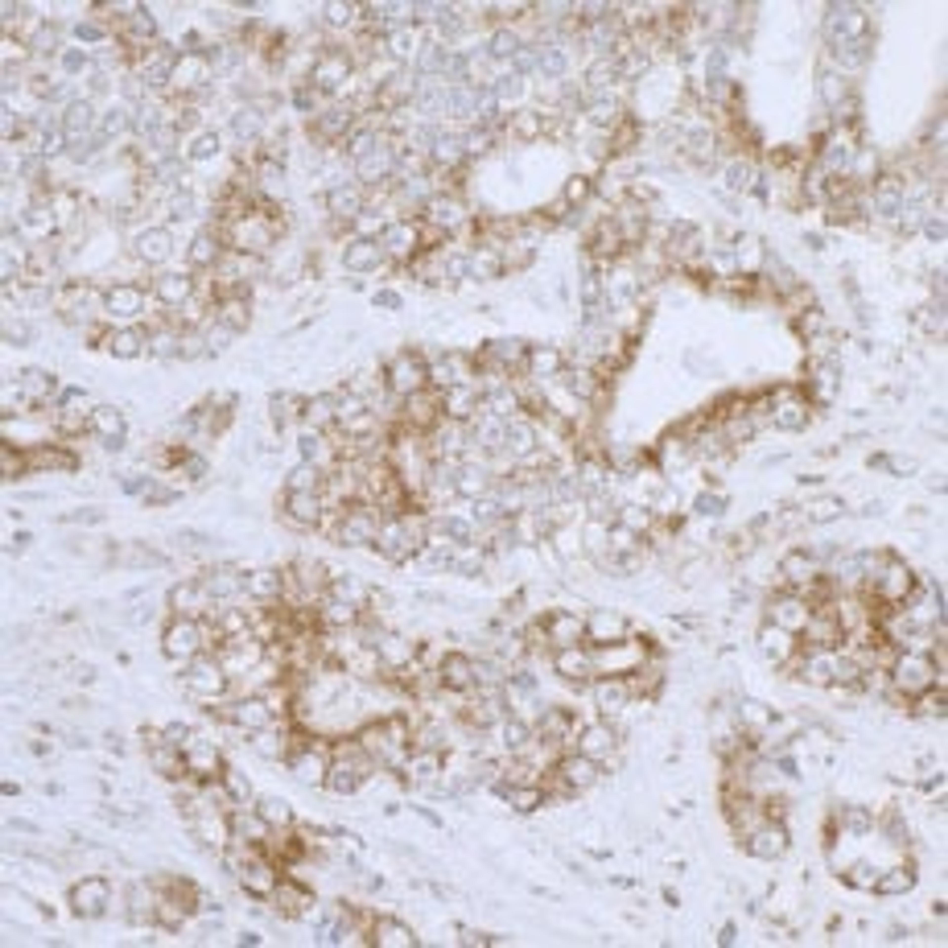 Detection of human DLD by immunohistochemistry.