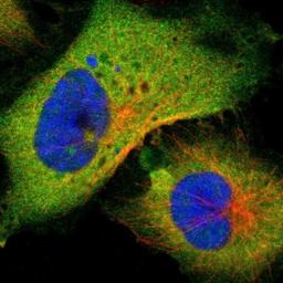 Immunocytochemistry/Immunofluorescence: PNCK Antibody [NBP1-86652] - Immunofluorescent staining of human cell line U-251MG shows positivity in plasma membrane & cytoplasm.