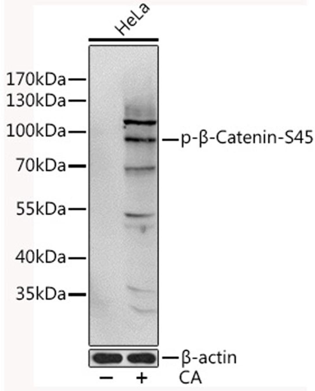 Western blot - Phospho-ß-Catenin-S45 antibody (AP0580)