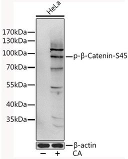 Western blot - Phospho-ß-Catenin-S45 antibody (AP0580)