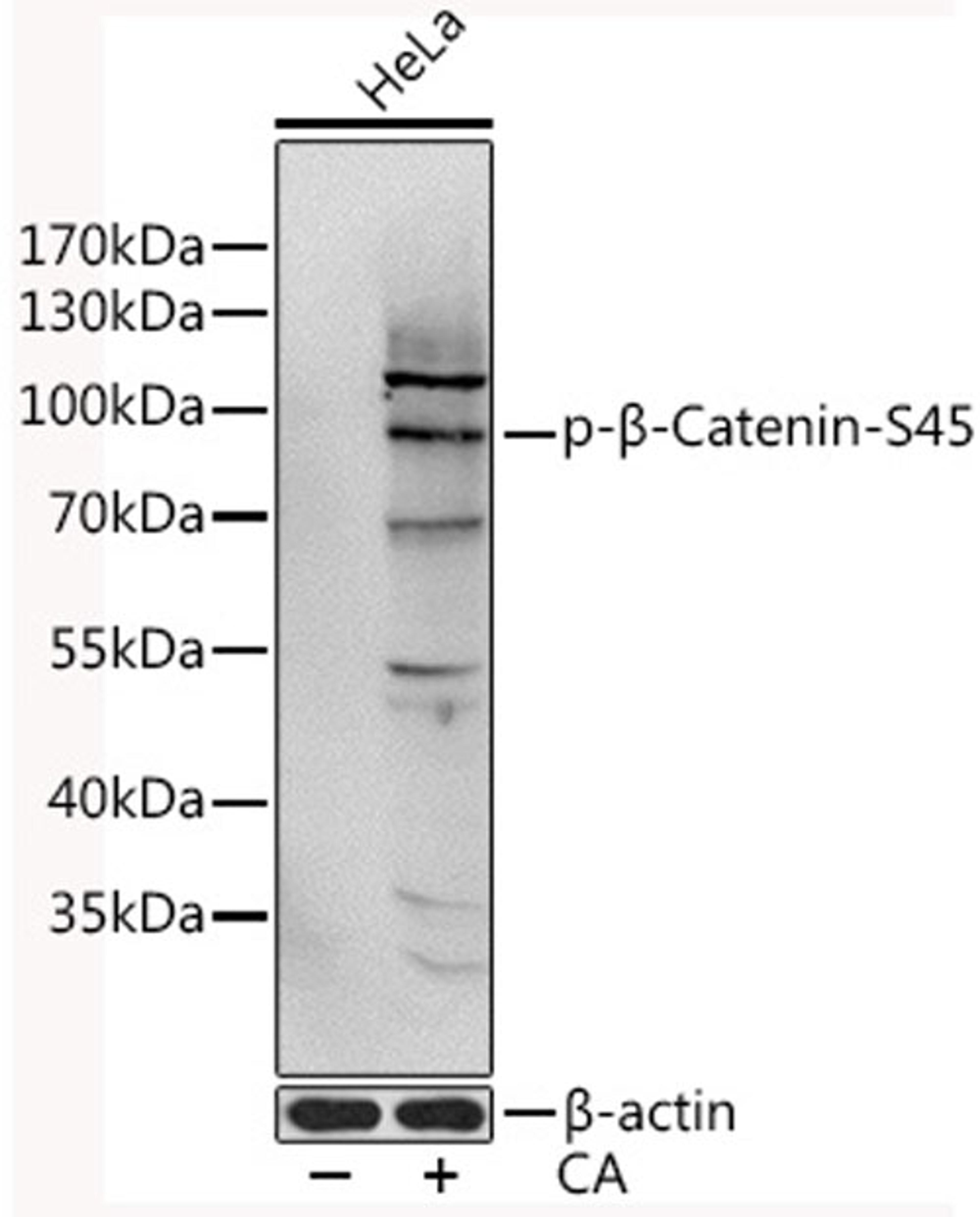 Western blot - Phospho-ß-Catenin-S45 antibody (AP0580)