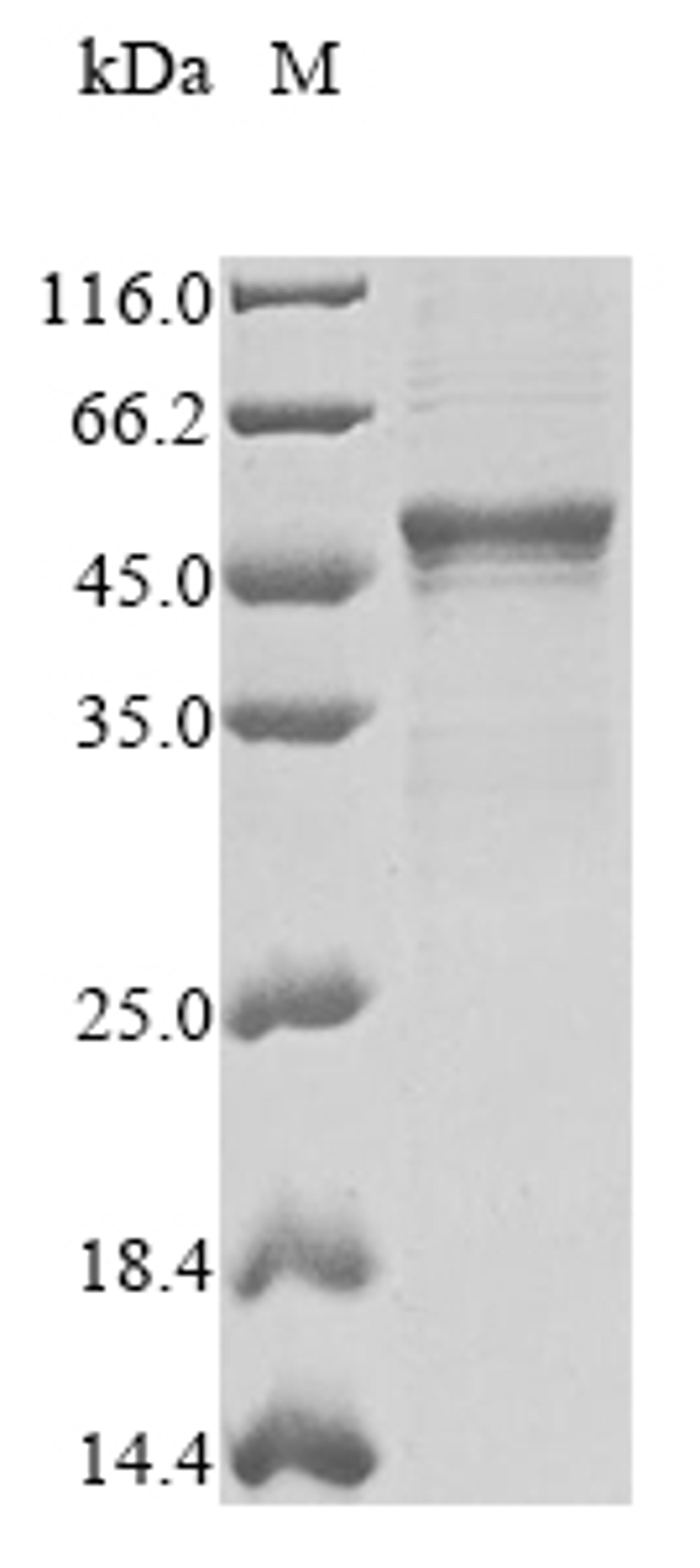 (Tris-Glycine gel) Discontinuous SDS-PAGE (reduced) with 5% enrichment gel and 15% separation gel.