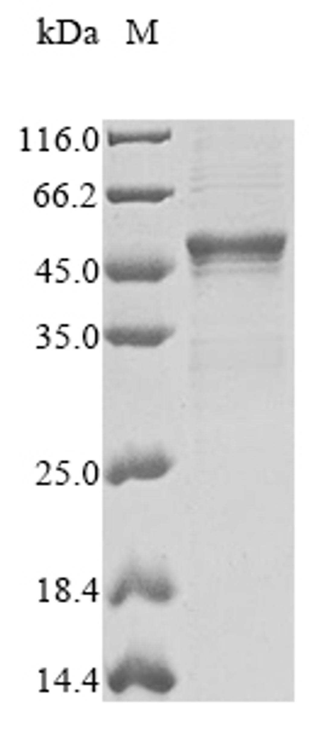 (Tris-Glycine gel) Discontinuous SDS-PAGE (reduced) with 5% enrichment gel and 15% separation gel.