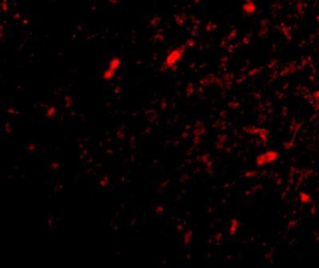 Immunocytochemistry/Immunofluorescence: FBXL20 Antibody [NBP1-77317] - Immunofluorescence of scrapper in human brain tissue with scrapper antibody at 20 ug/mL.